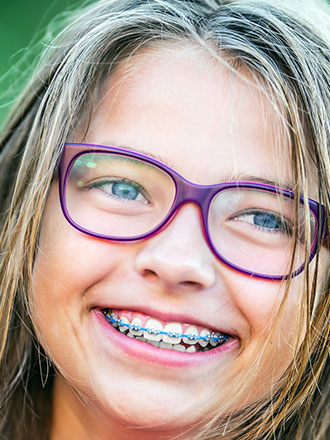color my braces