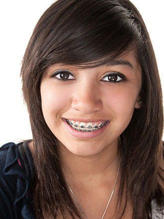 metal braces